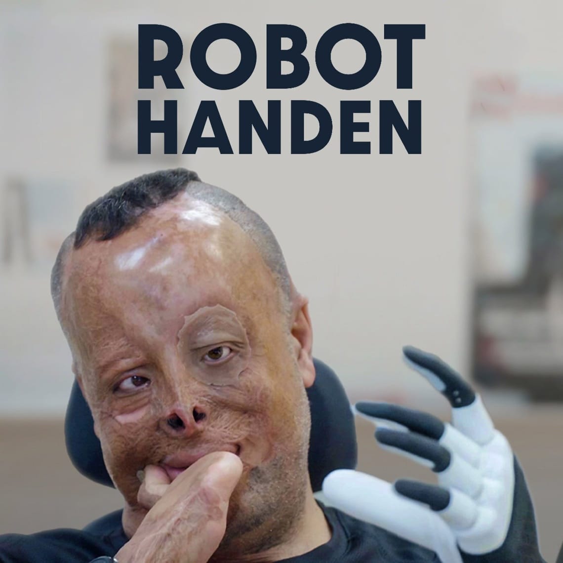 THE ROBOT HAND